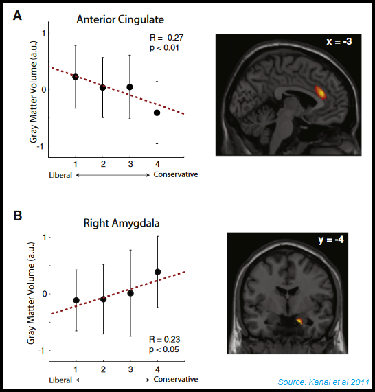 Brain scans show diff lefties and righties, photos and graphs, Kanai et al 2011.png